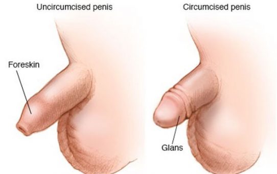 Uncircumcised and Circumcised